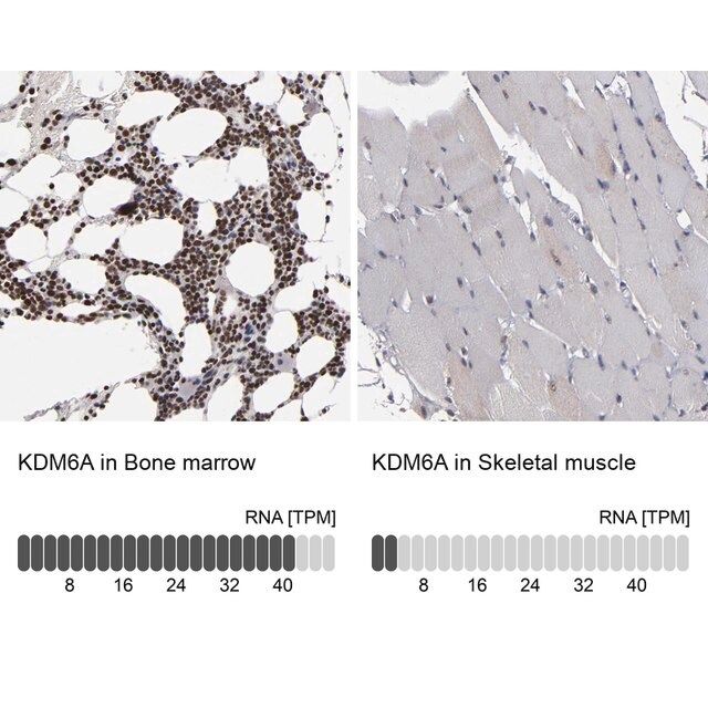 ANTI-KDM6A antibody produced in rabbit