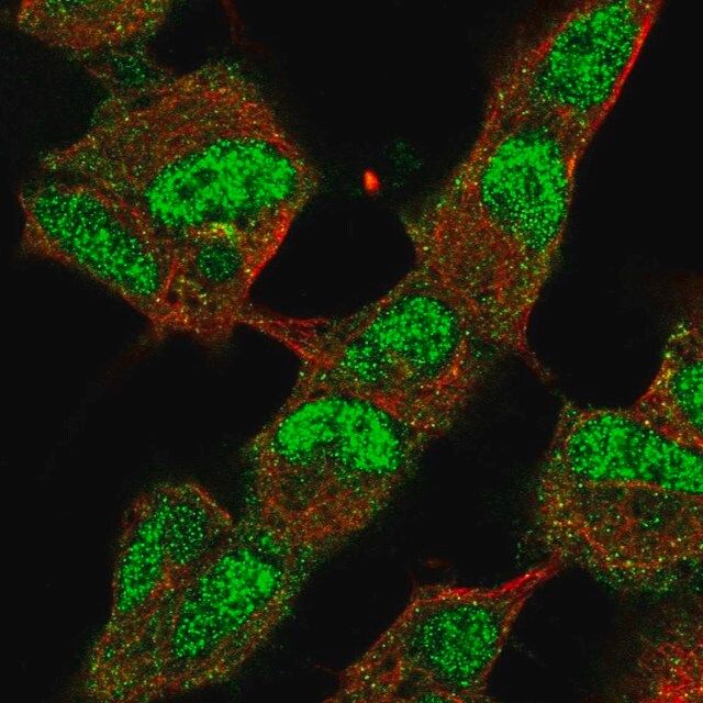 Anti-KDM4B antibody produced in rabbit