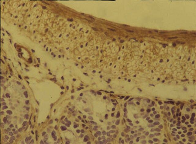 Anti-Integrin α5β1 Antibody, clone BMC5