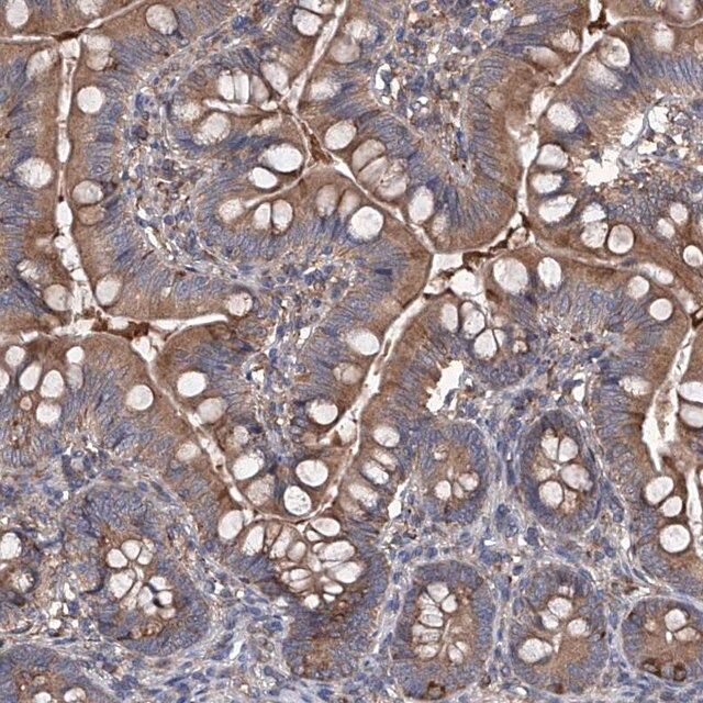 Anti-INPP5B antibody produced in rabbit