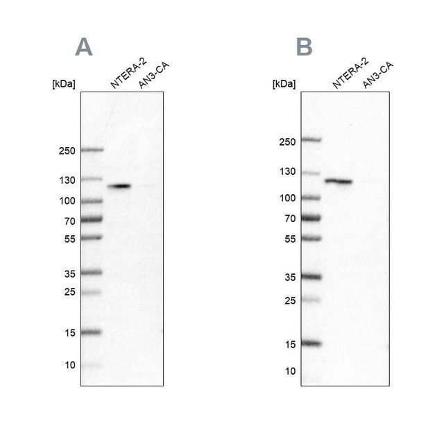 Anti-HSPH1 antibody produced in rabbit