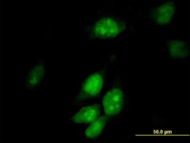 Anti-HTF9C antibody produced in mouse