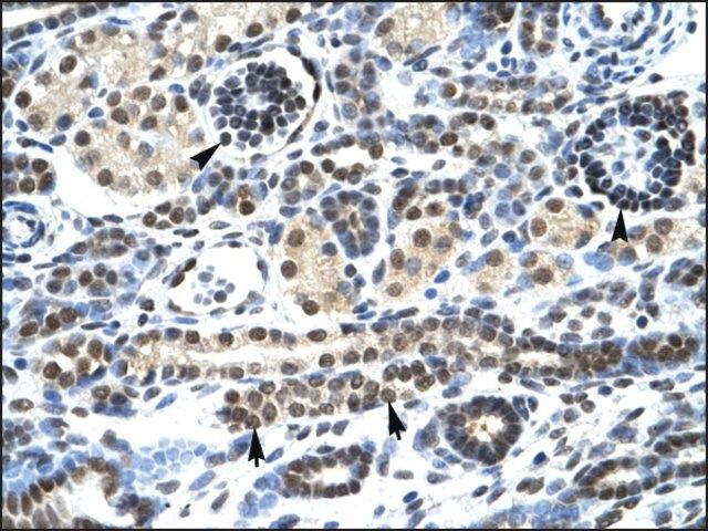 Anti-HTR3A