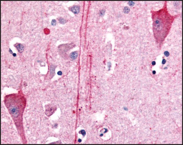 Anti-HTR7 (AB2) antibody produced in rabbit