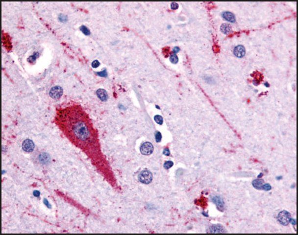 Anti-HTR5A (AB2) antibody produced in rabbit