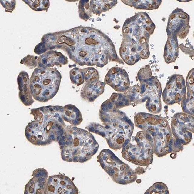 Anti-HTRA3 antibody produced in rabbit