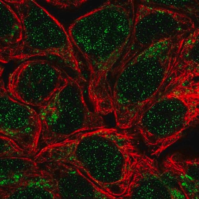 Anti-HS2ST1 antibody produced in rabbit
