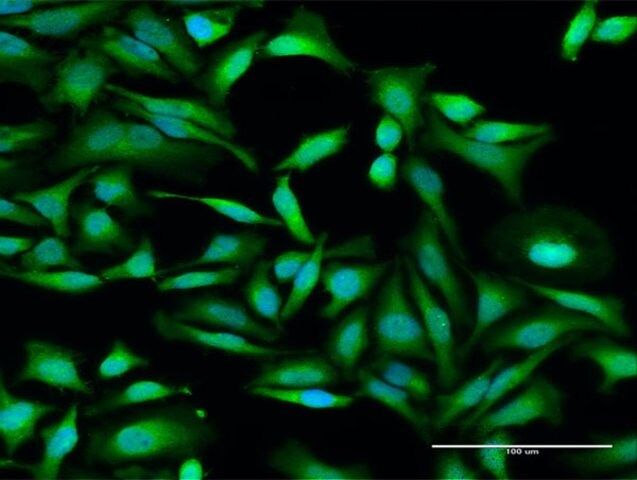 Anti-IFIT2 antibody produced in rabbit