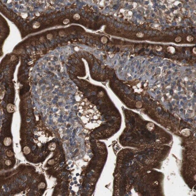 Anti-IFFO2 antibody produced in rabbit