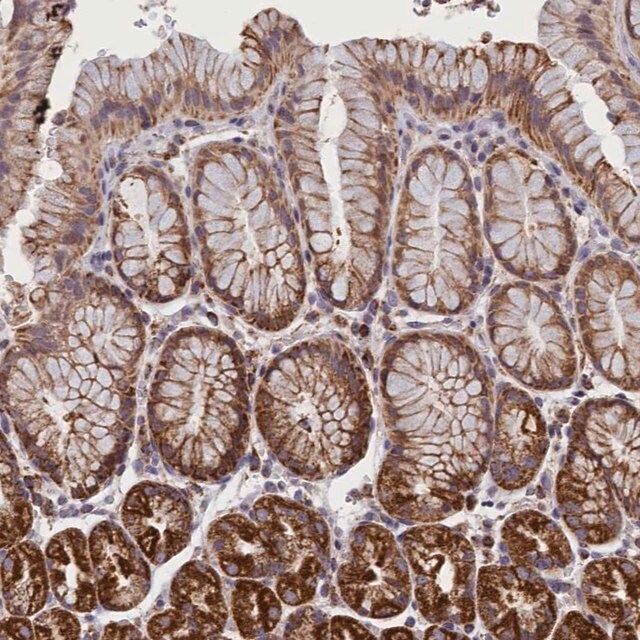 Anti-IFT122 antibody produced in rabbit