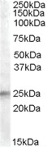 Anti-IGFBP6 antibody produced in goat