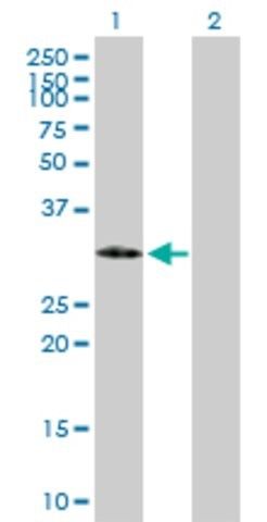 Anti-IGFBP2 antibody produced in mouse
