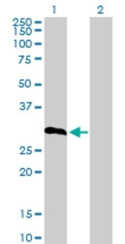 Anti-IGFBP6 antibody produced in rabbit