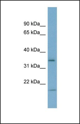 Anti-IGFBP2 antibody produced in rabbit