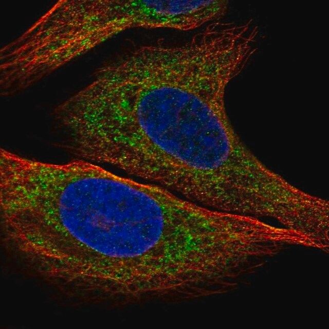 Anti-IGFBP2 antibody produced in rabbit
