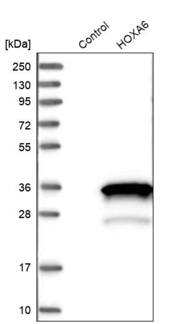 Anti-HOXA6 antibody produced in rabbit
