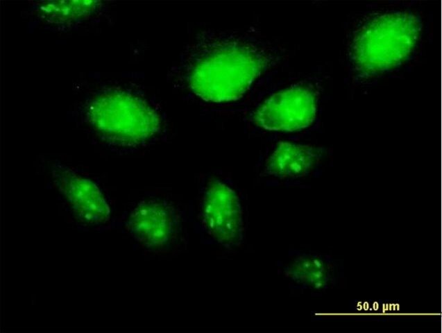 Anti-HSPA2 antibody produced in mouse