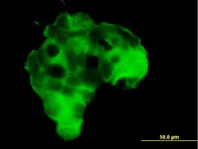 Anti-GRM2 antibody produced in mouse