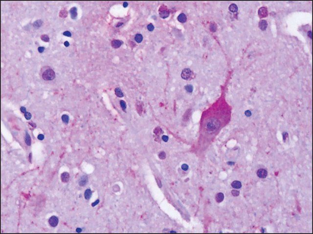 Anti-GRM4 / MGLUR4 antibody produced in rabbit