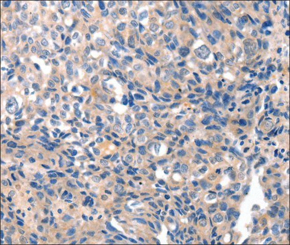 Anti-GRIN2D antibody produced in rabbit