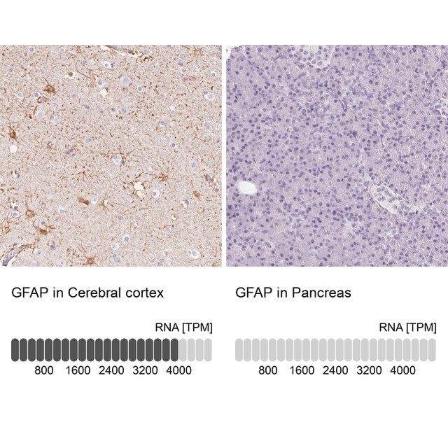 Anti-GFAP antibody produced in rabbit