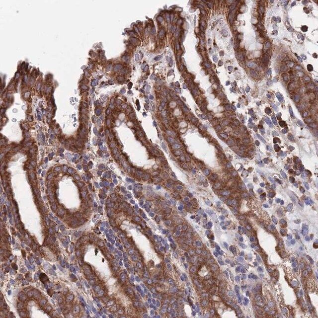 Anti-GID8 antibody produced in rabbit