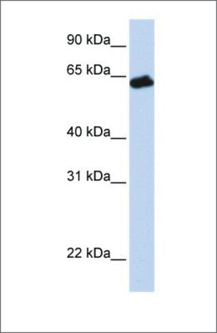 Anti-GHR antibody produced in rabbit