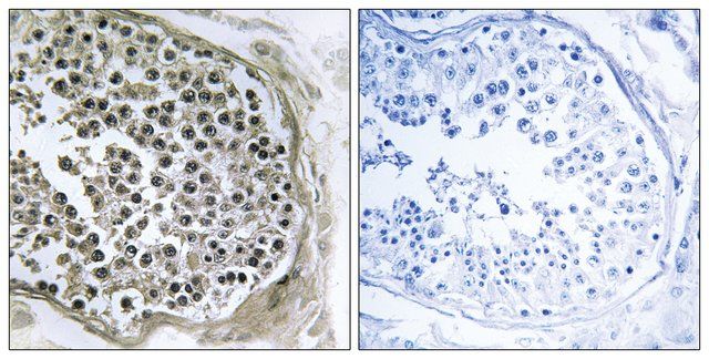 Anti-GIDRP88 antibody produced in rabbit