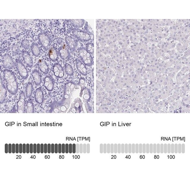 Anti-GIP antibody produced in rabbit
