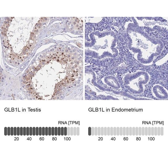 Anti-GLB1L antibody produced in rabbit