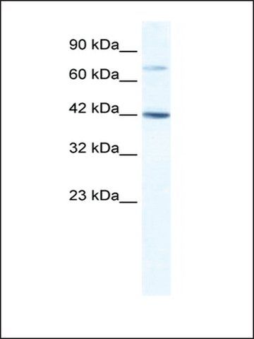 Anti-GLI4 antibody produced in rabbit