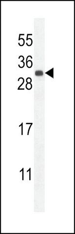 ANTI-FGF9(N-TERMINAL) antibody produced in rabbit
