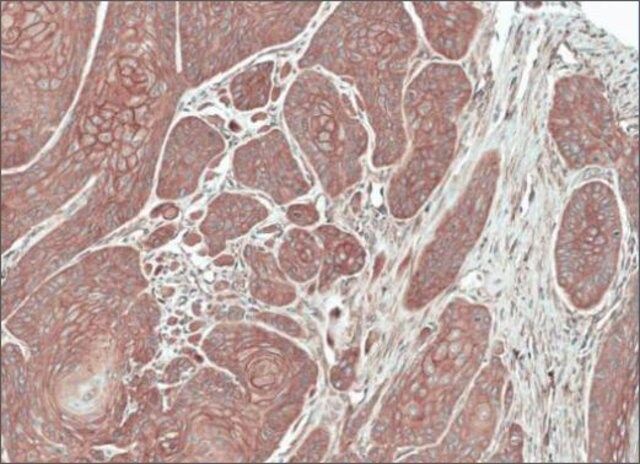 Anti-FGFRL1 antibody produced in rabbit