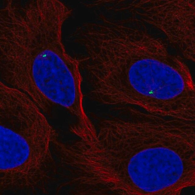 Anti-FGFR1OP antibody produced in rabbit