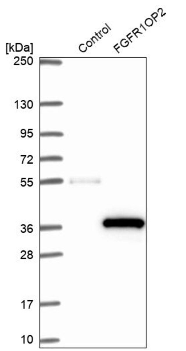 Anti-FGFR1OP2 antibody produced in rabbit
