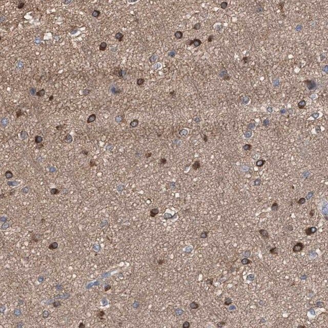 Anti-FHOD3 antibody produced in rabbit