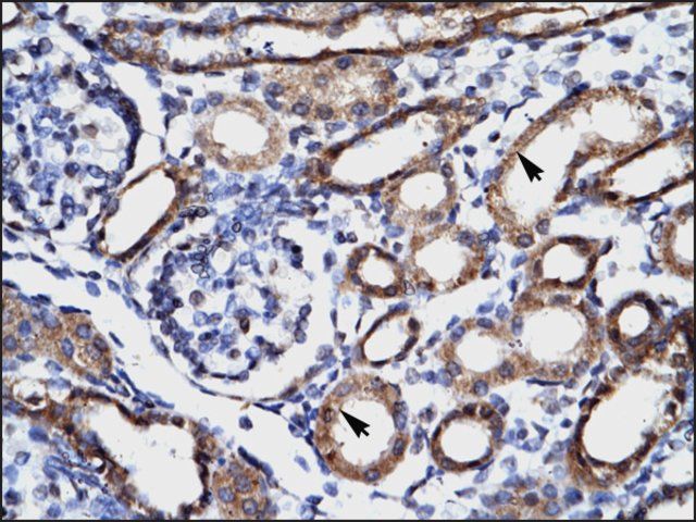 Anti-FHL1 antibody produced in rabbit