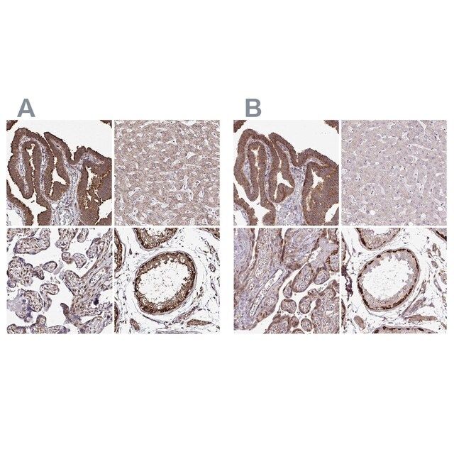 Anti-FMR1 antibody produced in rabbit
