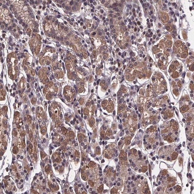 Anti-FN3KRP antibody produced in rabbit