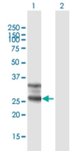 Anti-FOLR1 antibody produced in mouse