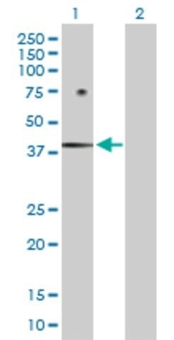 Anti-FOSB antibody produced in rabbit
