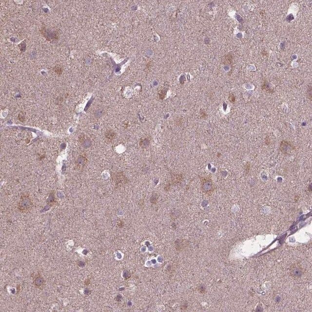 Anti-FAM114A1 antibody produced in rabbit