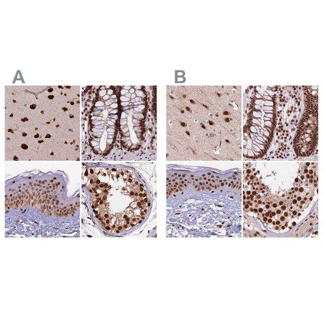 Anti-FAM103A1 antibody produced in rabbit