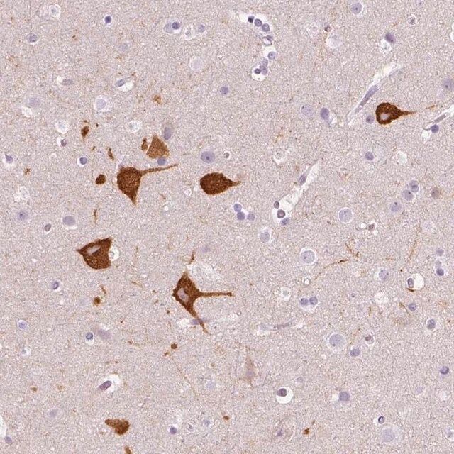 Anti-FAM163B antibody produced in rabbit