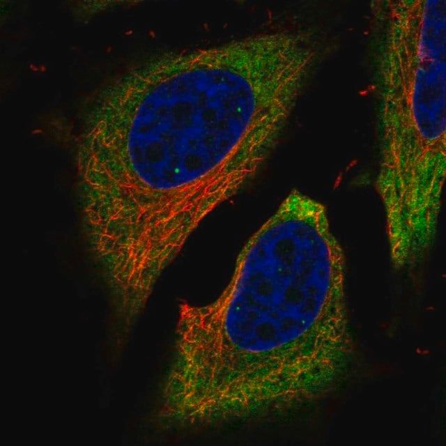 Anti-FAM134B antibody produced in rabbit