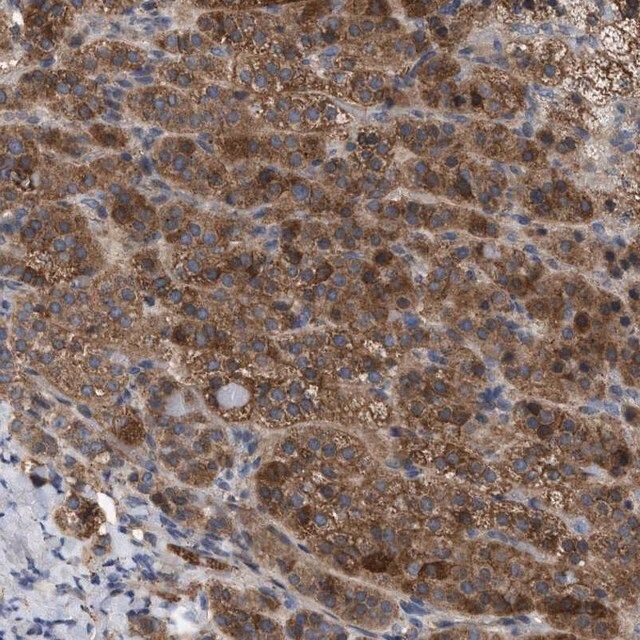 Anti-FAM171A2 antibody produced in rabbit