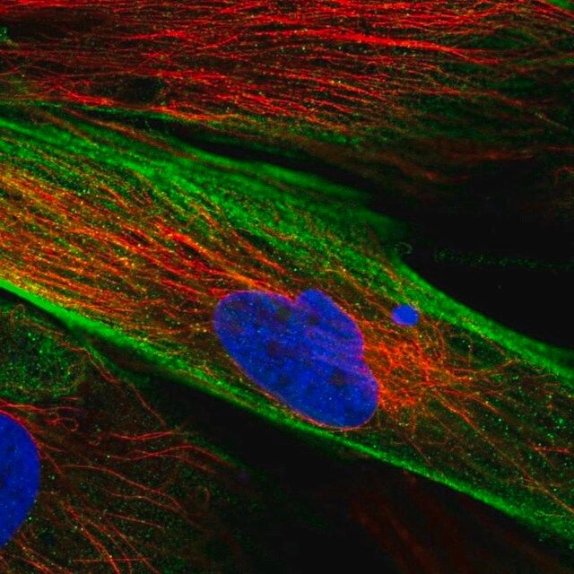 Anti-FAM167B antibody produced in rabbit
