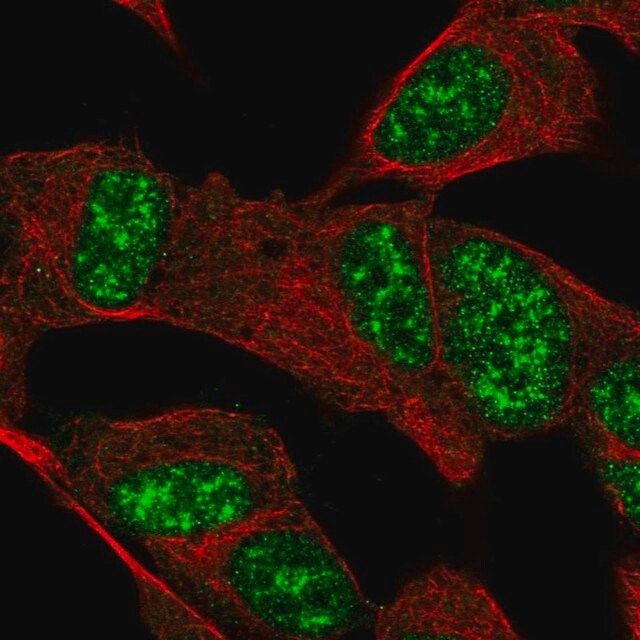 Anti-FAM227B antibody produced in rabbit