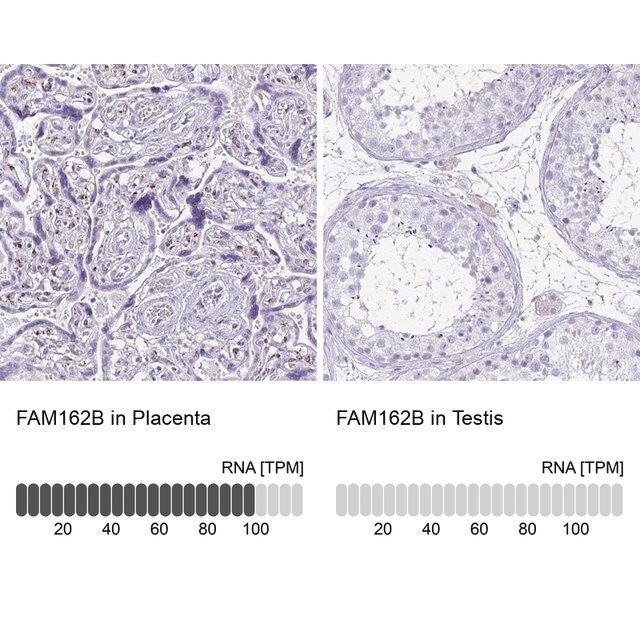 Anti-FAM162B antibody produced in rabbit