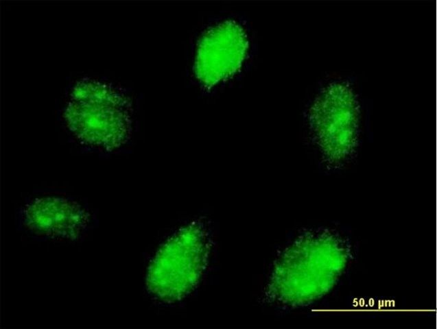 Anti-ETV7 antibody produced in mouse